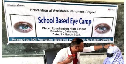 পলাশবাড়ীতে এসকেএসের বিনামূল্যে চক্ষু ক্যাম্প
